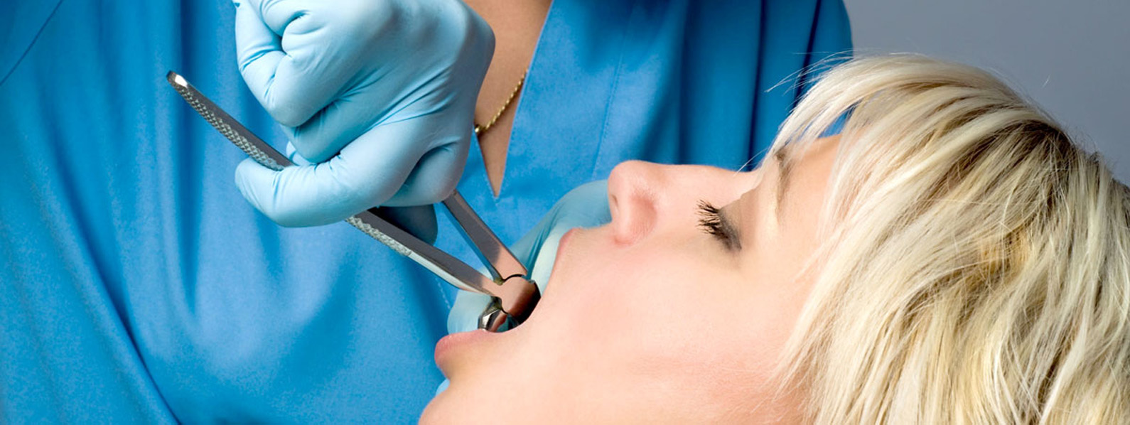 Процедура удаления зуба