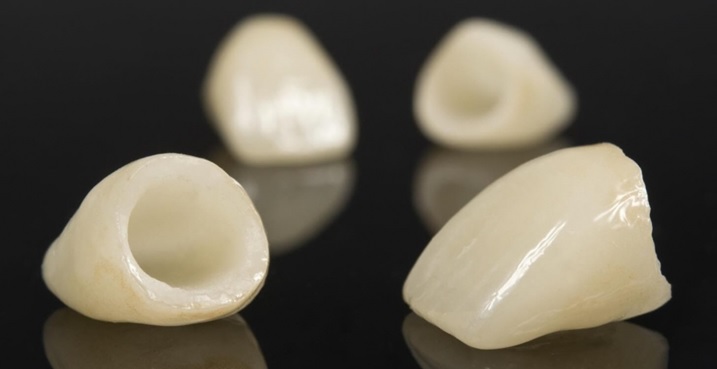 Одиночные коронки на зубы